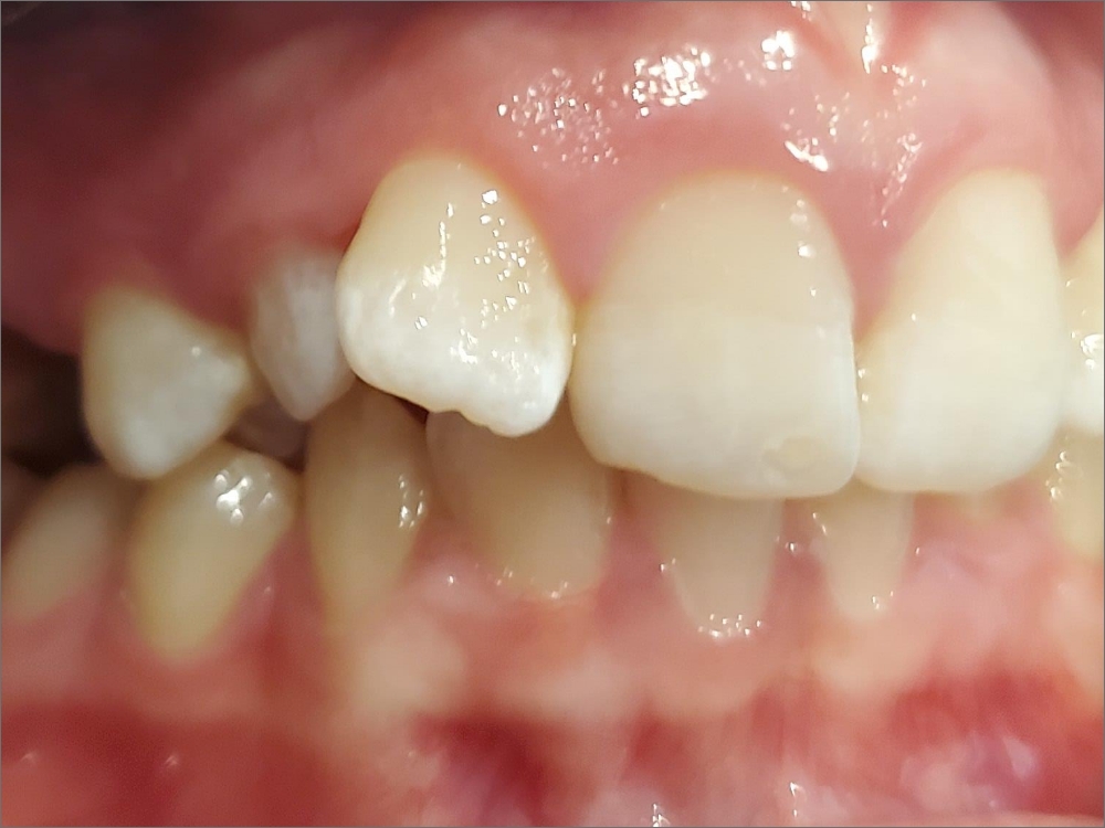 Professional Dentistry Kiln Creek, VA Smiles of Kiln Creek